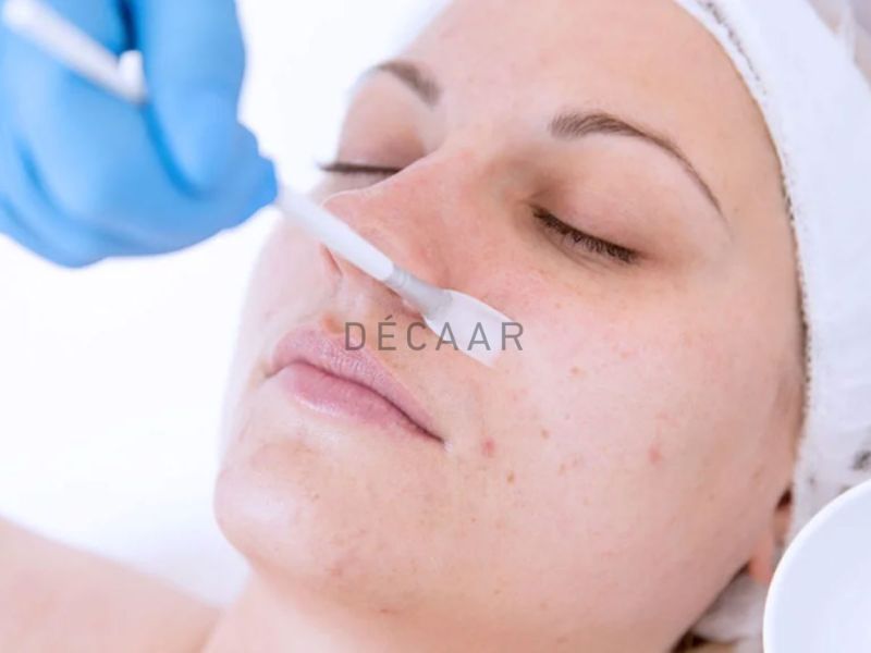 Thực hiện đúng quy trình peel da